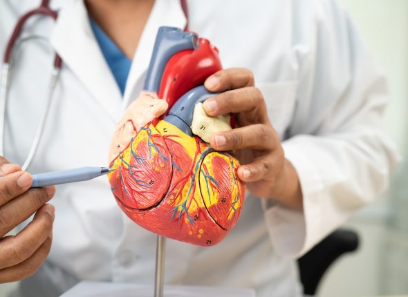Cardiovascular disease CVD, Asian doctor holding human anatomy m