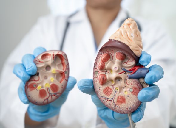 Chronic kidney disease, doctor with model for treatment urinary