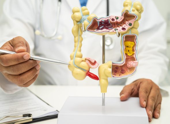 Intestine, appendix and digestive system, doctor holding anatomy