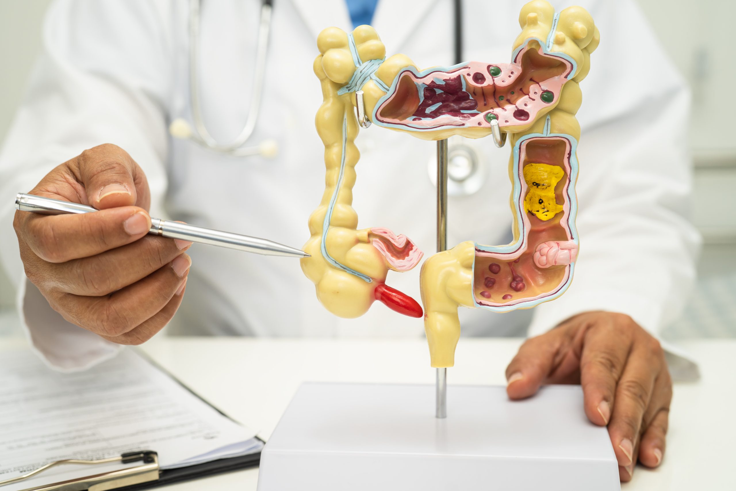 Gastrointestinal System & Hepatobiliary
