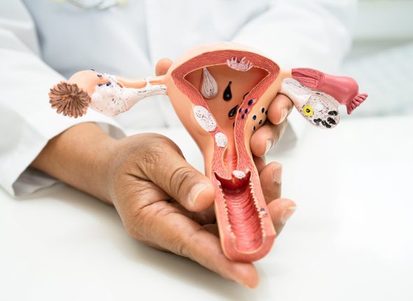 Uterus, doctor with anatomy model for study diagnosis and treatm